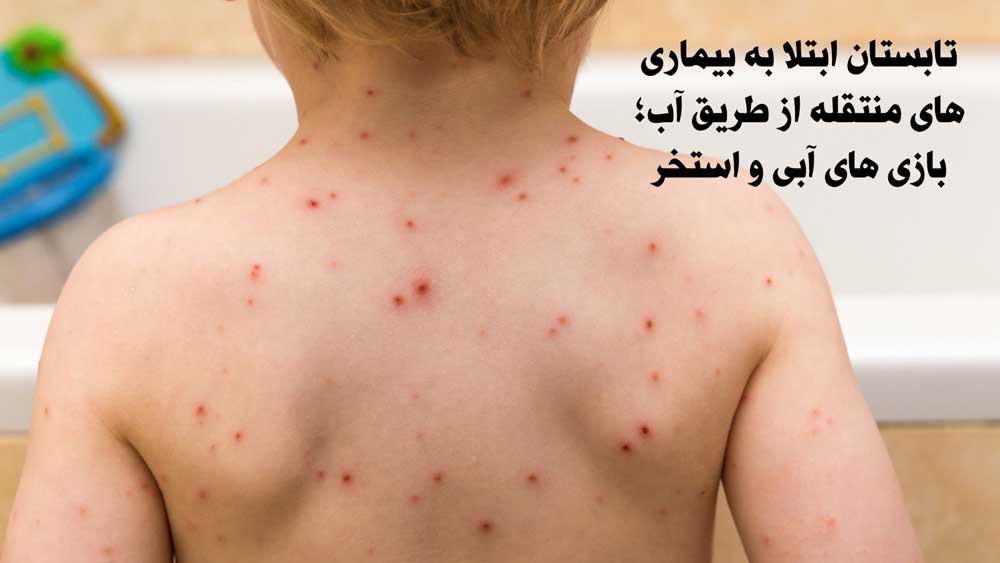 تابستان ابتلا به بیماری های منتقله از طریق آب؛ بازی های آبی و استخر
